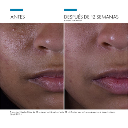 SILYMARIN CF